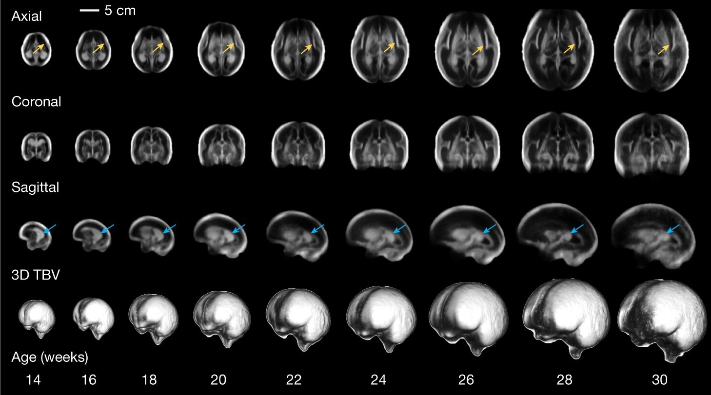 A fost publicat primul atlas digital al dezvoltării creierului fetal uman