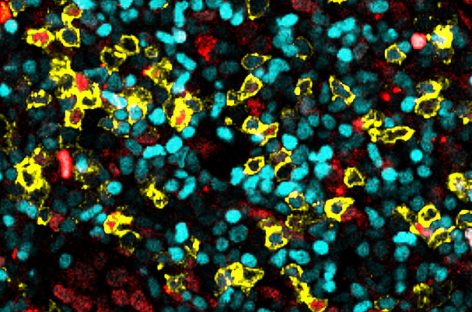 Celule T, gardienii imunitari, descoperite în ganglionii limfatici