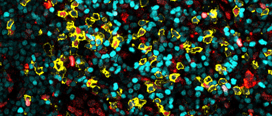 Celule T, gardienii imunitari, descoperite în ganglionii limfatici