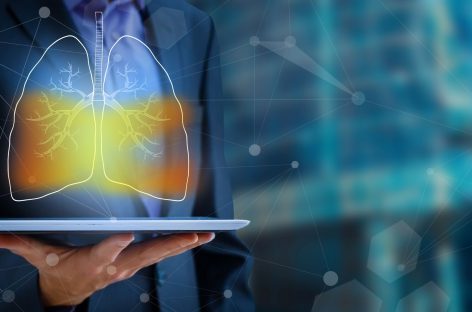 Inteligența artificială ar putea fi mai bună decât oamenii în detectarea cancerului pulmonar
