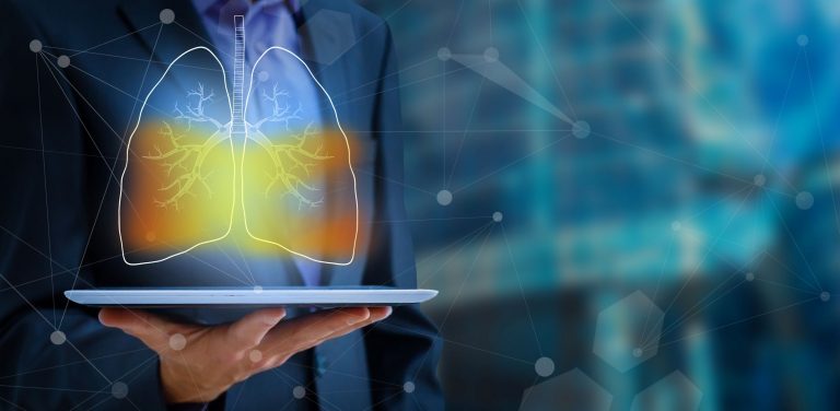 Inteligenţa artificială ar putea fi mai bună decât oamenii în detectarea cancerului pulmonar