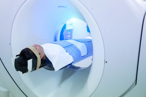 Scanările cardiace ar putea indica riscul de Parkinson şi demenţă cu corpi Lewy, sugerează noi cercetări