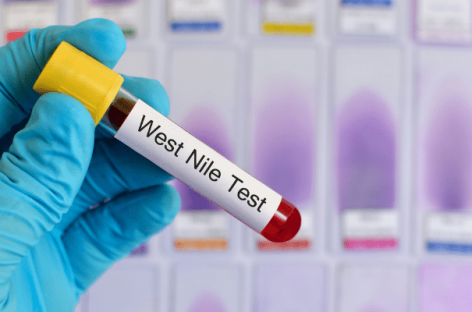 Un nou caz de infecţie cu virusul West Nile