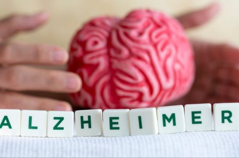 Boala Alzheimer era „excepțional” de rară la grecii și romanii antici, sugerează un studiu