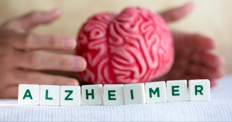 Un studiu a detectat noi biomarkeri ai maladiei Alzheimer