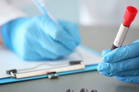 Testele de sânge pentru depistarea cancerului colorectal ar putea extinde opţiunile de screening