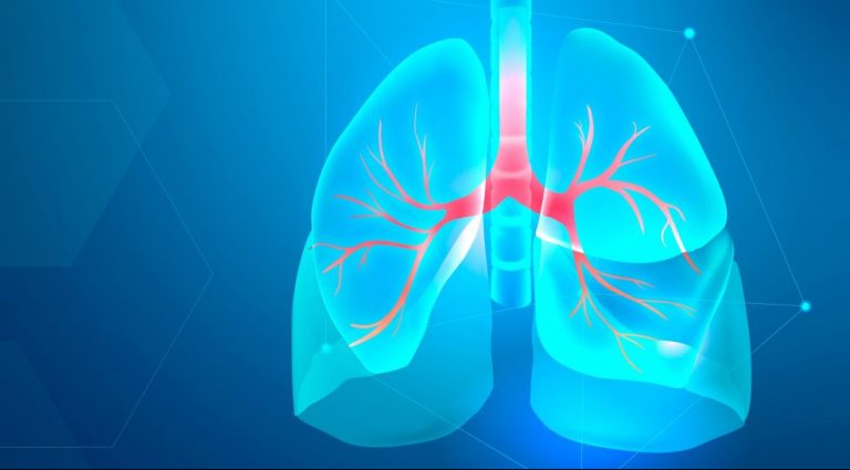 Un tratament experimental pentru o boală pulmonară rară îşi atinge obiectivele în testele clinice avansate