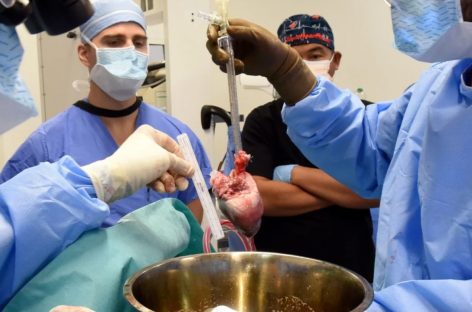 Xenotransplanturile, viitorul transplantului de organe în câţiva ani, potrivit Sesiunilor ştiinţifice ale Societăţii Internaţionale de Transplant de Inimă şi Plămâni de la Praga