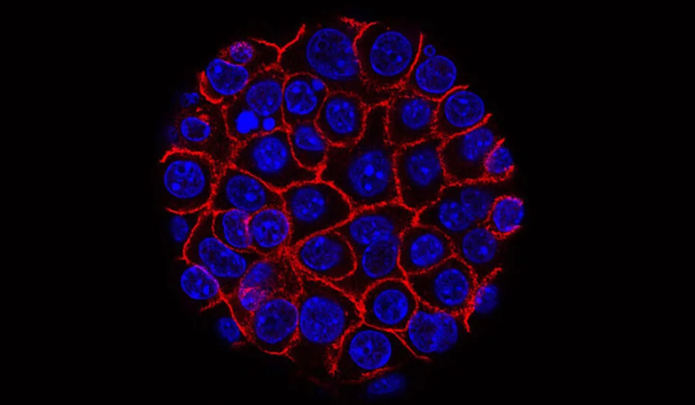 Oamenii de ştiinţă lucrează la primul test standard pentru depistarea precoce a cancerului pancreatic