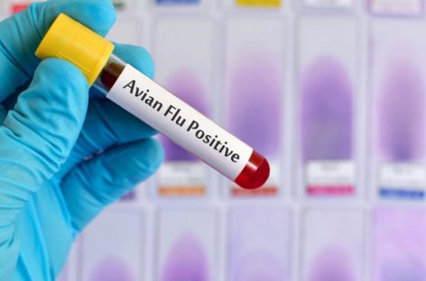 UPDATE: Primul deces asociat infecţiei cu tulpina H5N2 a virusul gripei aviare. OMS precizează că decesul a fost cauzat de mai mulţi factori