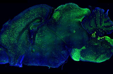 O nouă metodă de screening CRISPR ar putea dezvălui cauza bolilor creierului