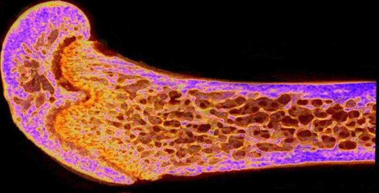 Oamenii de ştiinţă au descoperit un nou hormon care produce oase mai puternice