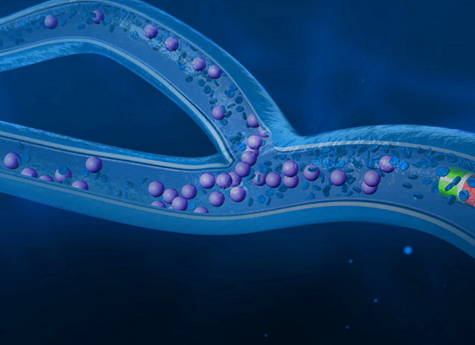 O terapie de radioembolizare împotriva cancerului de ficat, utilizată în premieră naţională la Institutul Clinic Fundeni