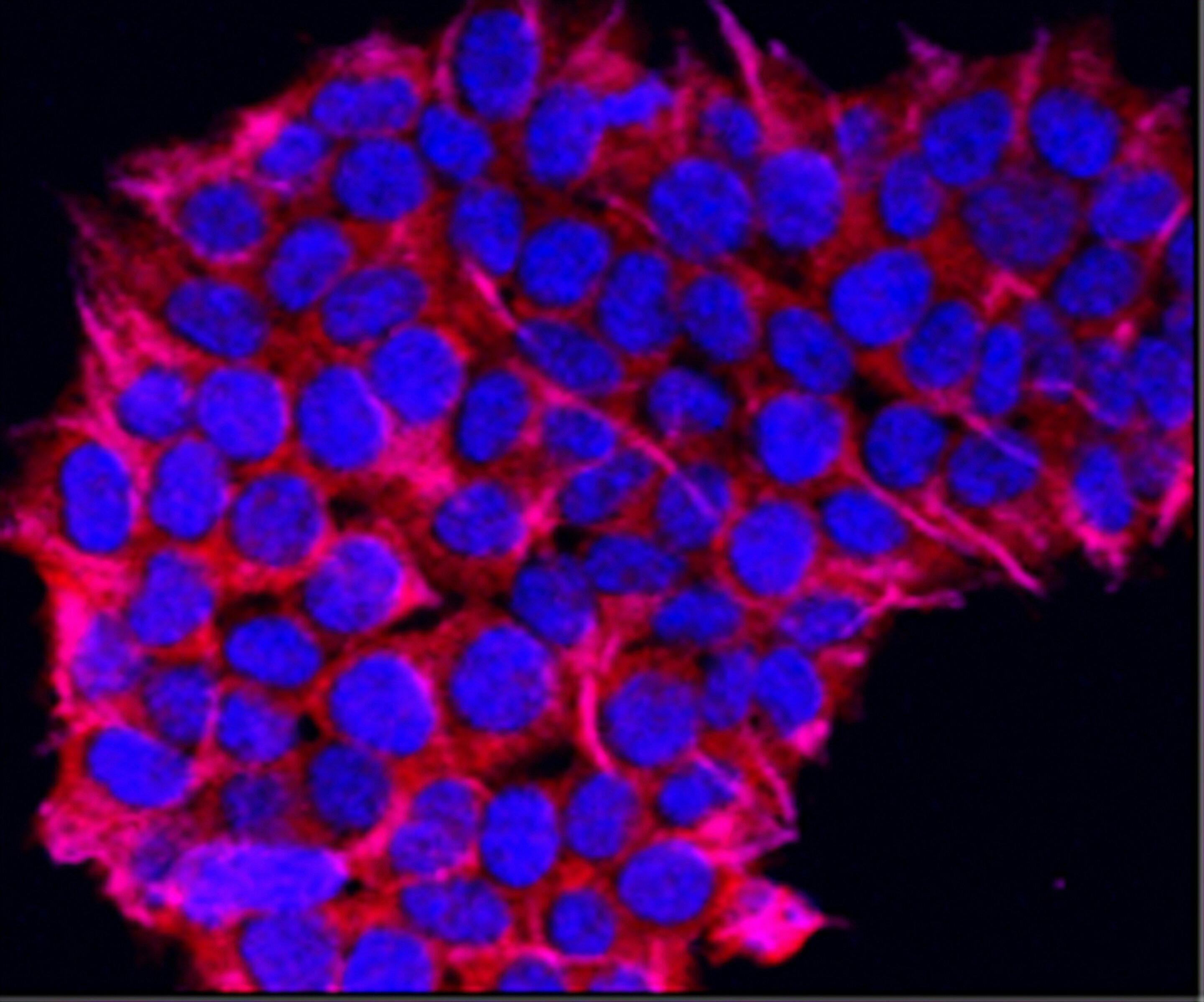 Oamenii de ştiinţă au descoperit un mecanism molecular care conduce scleroza multiplă şi alte boli autoimune