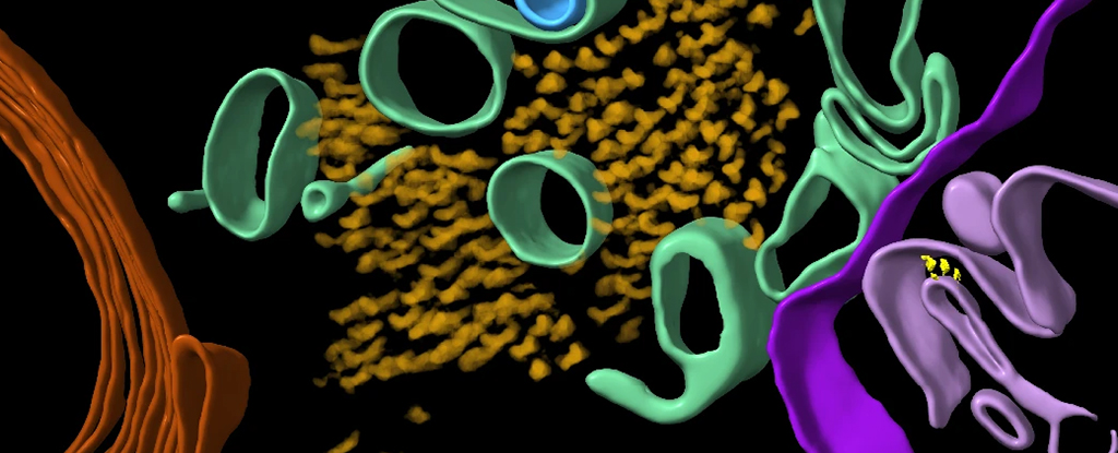 Structura moleculară 3D a creierului bolnav de Alzheimer, dezvăluită pentru prima dată