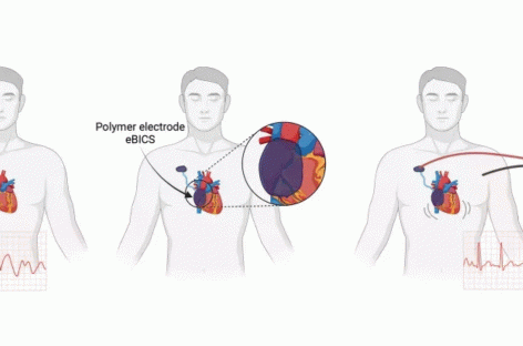 O echipă de cercetători a dezvoltat un stimulator cardiac injectabil pentru situaţiile de urgenţă