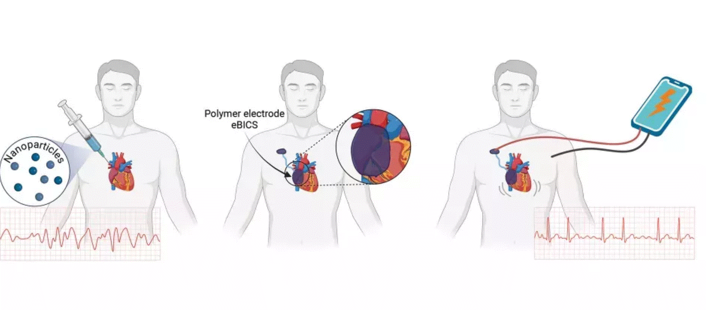 O echipă de cercetători a dezvoltat un stimulator cardiac injectabil pentru situaţiile de urgenţă