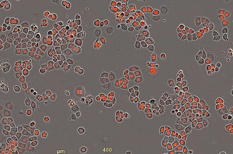 Cercetătorii în domeniul cancerului au dezvoltat o metodă care utilizează ceasul intern al celulelor tumorale pentru a optimiza terapiile