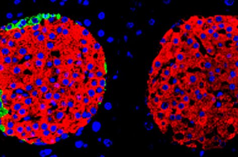 Celulele beta din pancreas pot regla singure nivelul zahărului din sânge, a constatat un studiu
