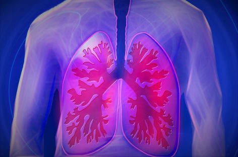 Cercetătorii au reuşit să îmbunătăţească răspunsul la imunoterapia cancerului pulmonar