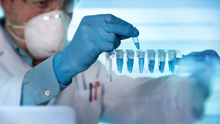 Primul test de urină pentru detectarea timpurie a cancerului pulmonar, dezvoltat la Universitatea Cambridge