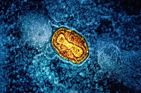 Un nou caz de infecţie în Europa cu noua variantă de mpox, identificat în Marea Britanie